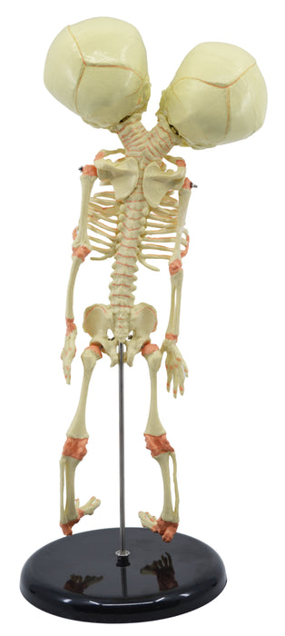 Infant Fetus Skeleton Model, Mini Size - Twin, Conjoined Skull - Rod Mounted - Incredible Detail for Anatomical Study - Eisco Labs
