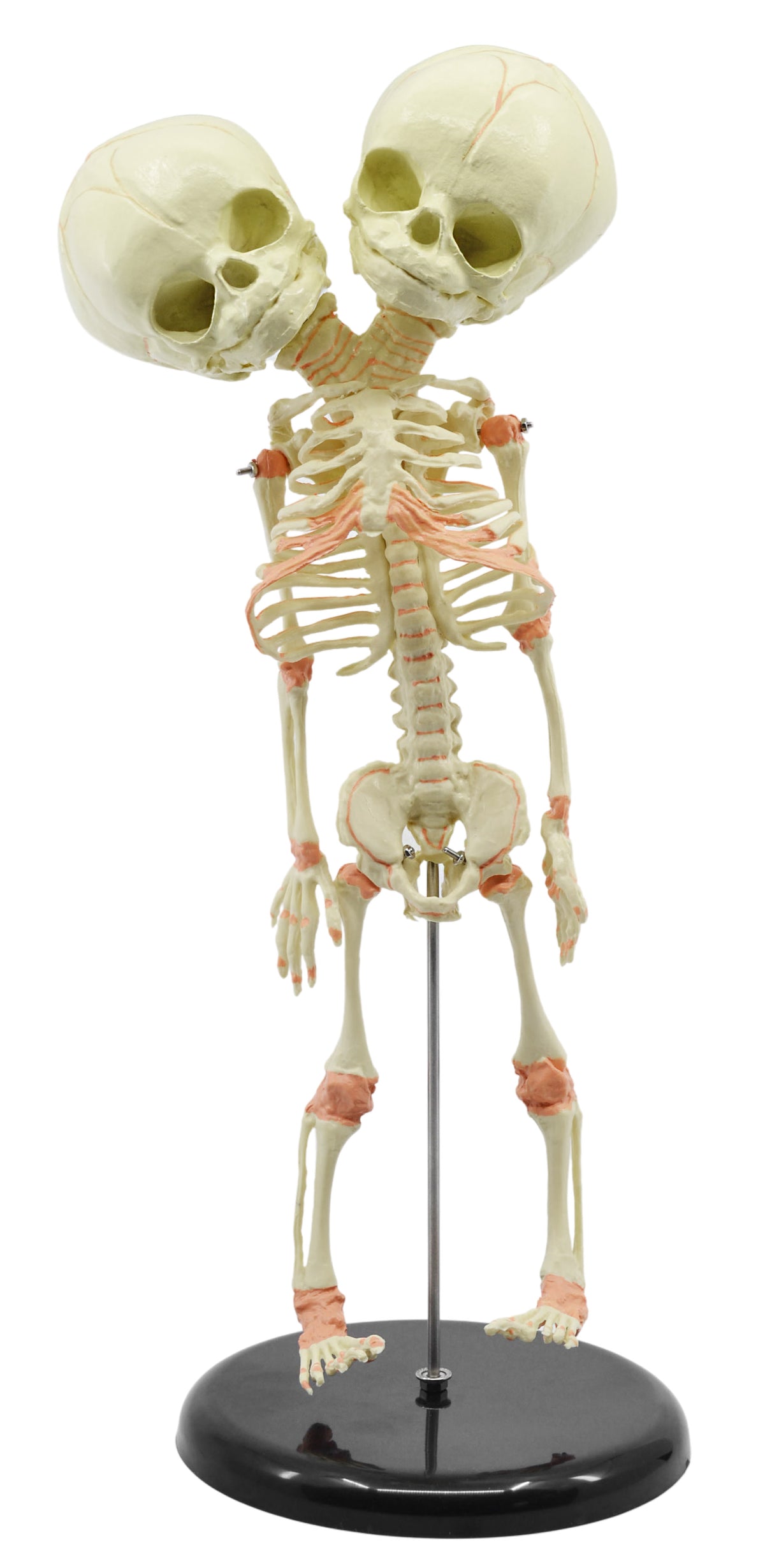 Infant Fetus Skeleton Model, Mini Size - Twin, Conjoined Skull
