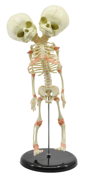Infant Fetus Skeleton Model, Mini Size - Twin, Conjoined Skull - Rod Mounted - Incredible Detail for Anatomical Study - Eisco Labs