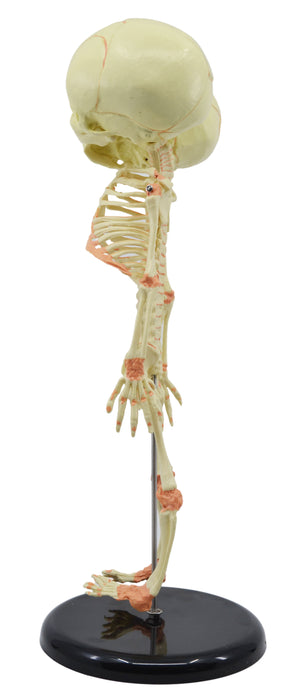 Infant Fetus Skeleton Model, Mini Size - Twin, Conjoined Skull - Rod Mounted - Incredible Detail for Anatomical Study - Eisco Labs
