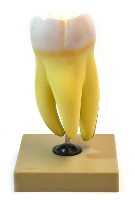 Eisco Labs Human Upper Triple Root Molar with interchangeable cavities - 6 parts