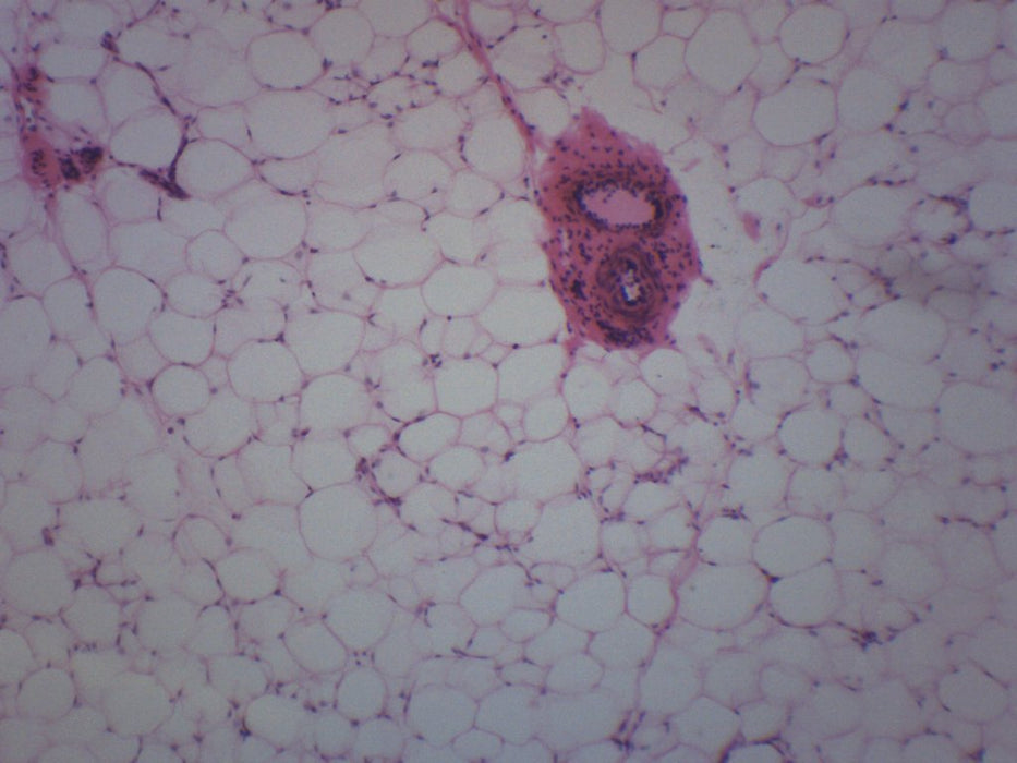 Adipose Tissue Section, Mammal - Prepared Microscope Slide - 75x25mm