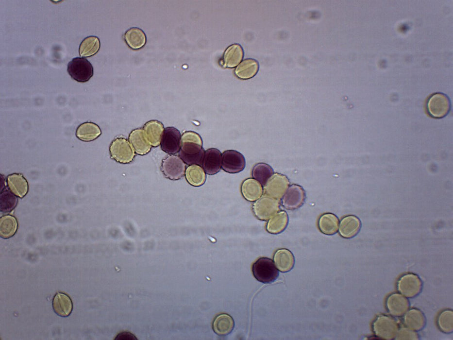 Ascaris Lumbricoides Egg - Wholemount - Prepared Microscope Slide - 75x25mm
