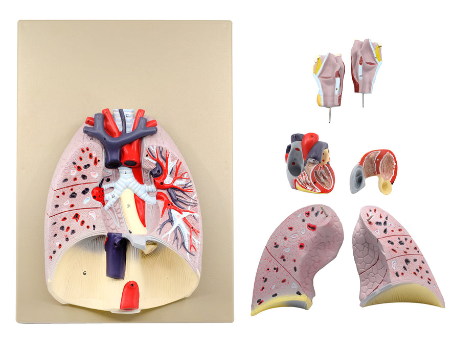 Advanced Heart & Lungs Model - Life Size - 7 Parts