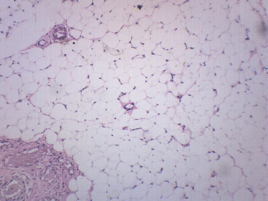 Adipose Tissue Section, Human - Prepared Microscope Slide - 75x25mm