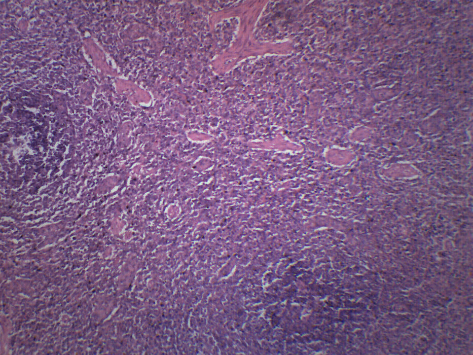 Human Spleen Section - Prepared Microscope Slide - 75x25mm
