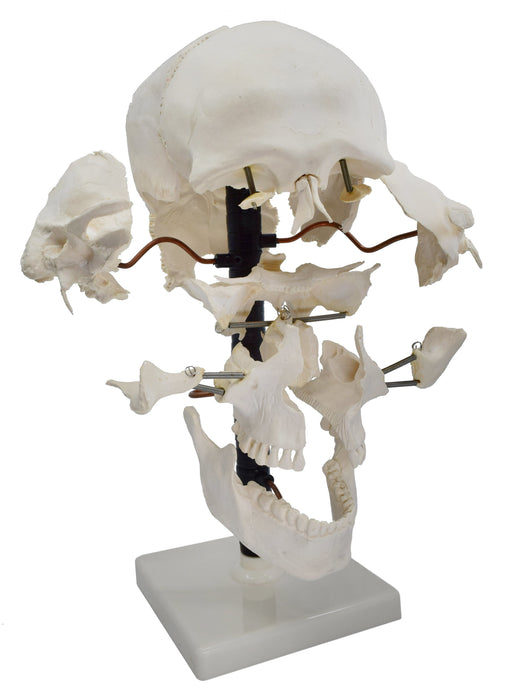 Beauchene Exploded Skull Model - 13 Parts - Life Size - Mounted on Stand