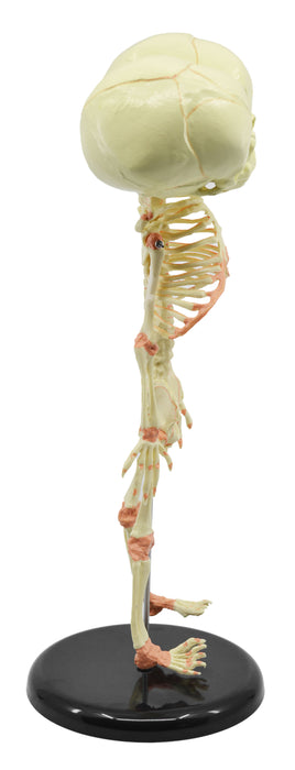 Infant Fetus Skeleton Model, Mini Size - Twin, Conjoined Skull - Rod Mounted - Incredible Detail for Anatomical Study - Eisco Labs