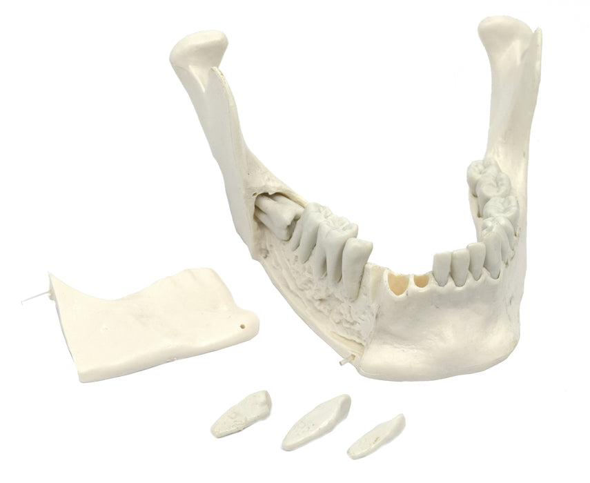 Lower Jaw Model, 16 Extractable Teeth - Anatomically Accurate