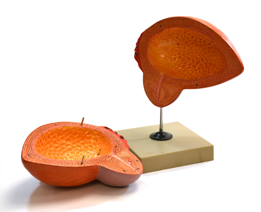Eisco Labs Human Urinary Bladder with Prostate Anatomical Model, 2 Parts, 3 Times Life Size, Approx. 8"x8"x6"