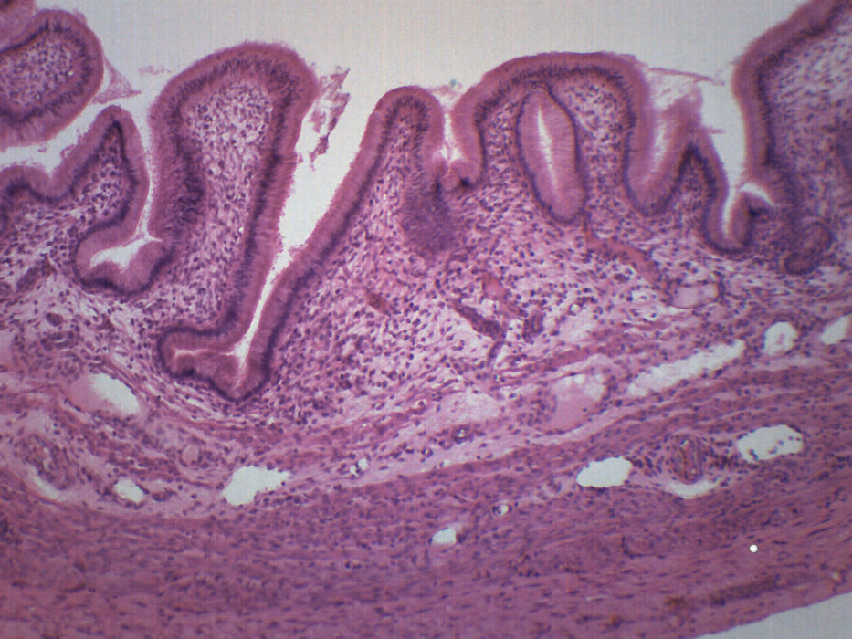 Gallbladder - Cross Section - Prepared Microscope Slide - 75x25mm