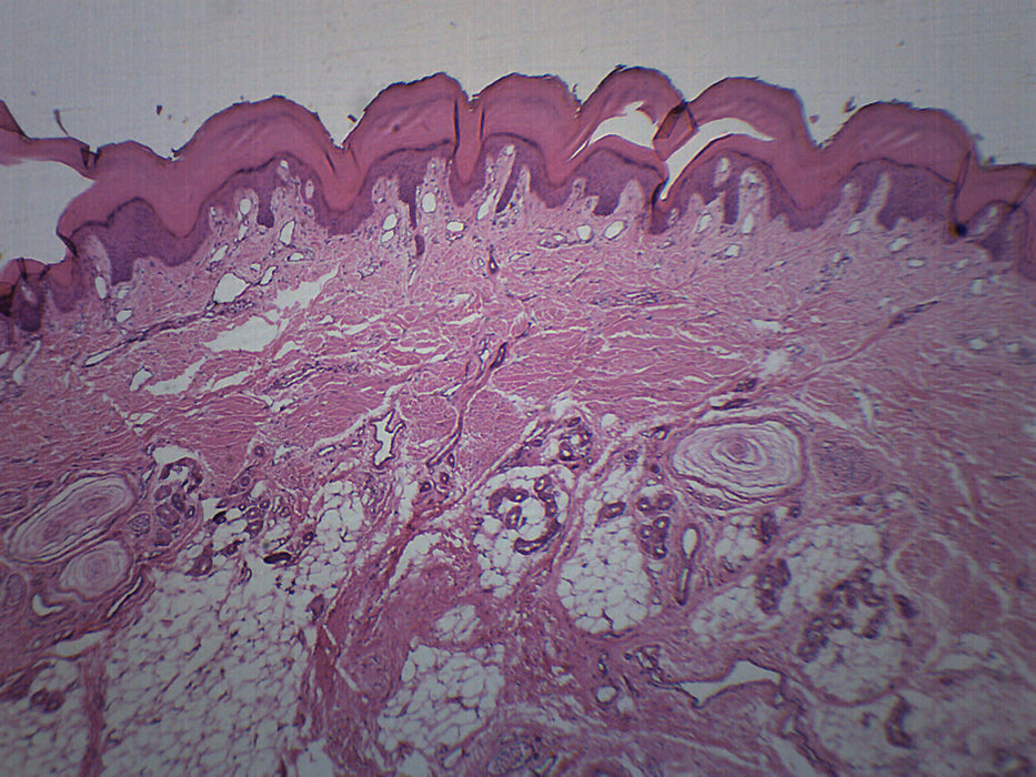 Human Skin - Cross Section - Prepared Microscope Slide - 75x25mm