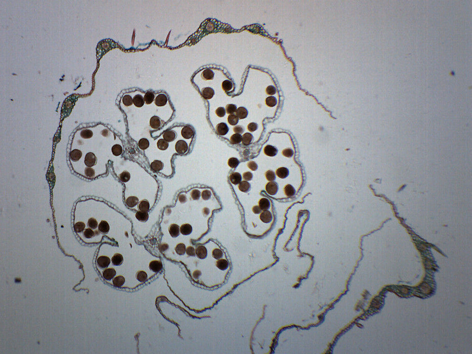 Monocot & Dicot Flower Bud - Cross Section - Prepared Microscope Slide - 75x25mm