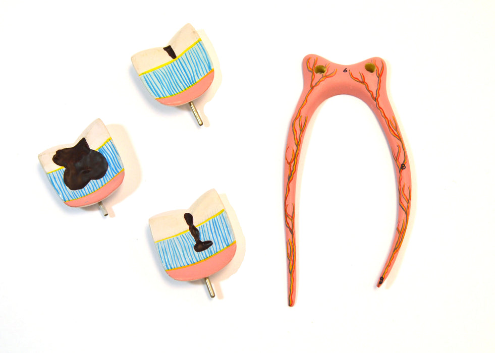 Eisco Labs Human Upper Triple Root Molar with interchangeable cavities - 6 parts