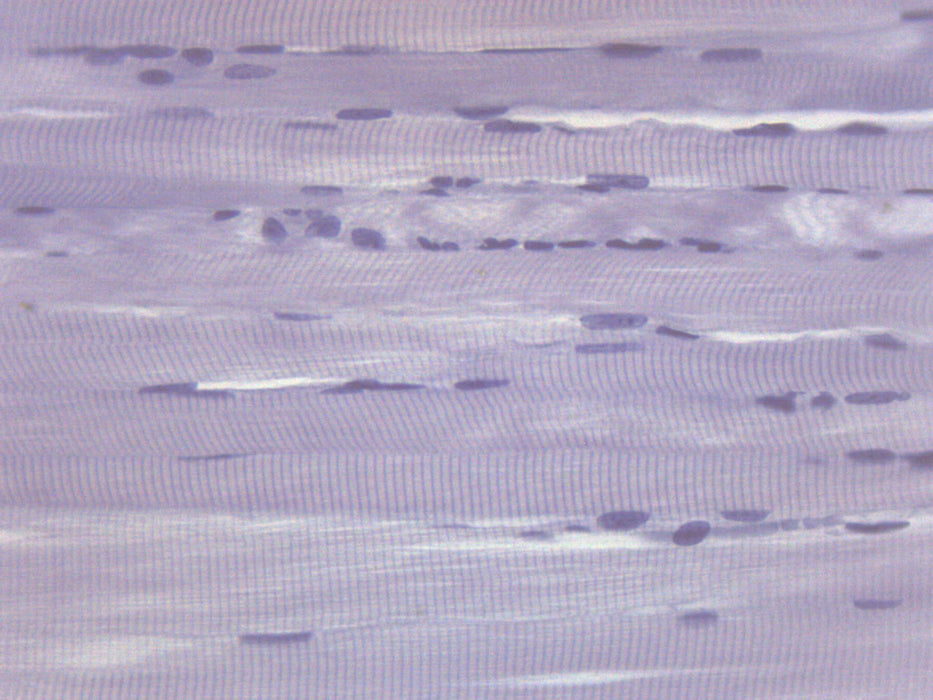Human Skeletal Muscle (LS) - Prepared Microscope Slide - 75x25mm