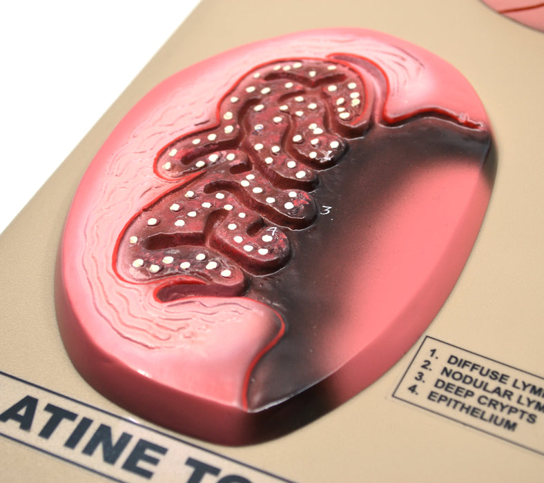 Premium Model of Tonsils - 3D View of Pharyngeal, Palatine, and Lingual Tonsils, Hand Painted with Key Card, Mounted on Base - Eisco Labs