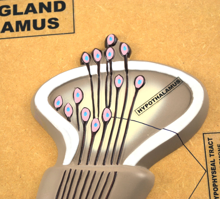 Eisco Labs Model of Pituitary Gland and Hypothalamus; Greatly Enlarged: