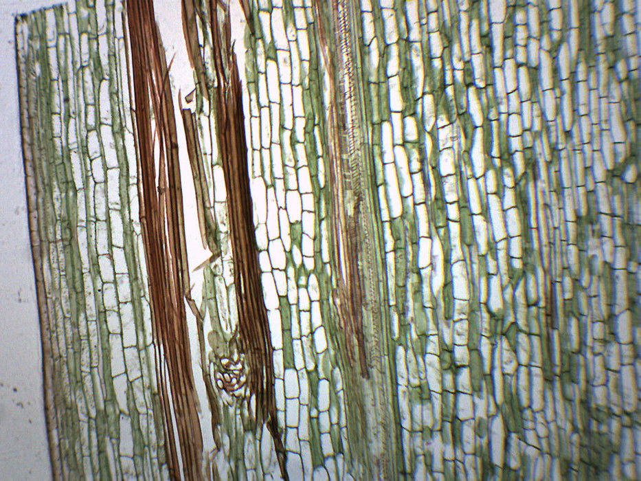 Iris Stem - Cross Section & Longitudinal Section - Prepared Microscope Slide - 75x25mm
