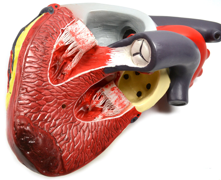Eisco Labs Model of Human Heart Conditions Pathology; Larger than life size (10"); Artery Cross sections 2.5" in diameter