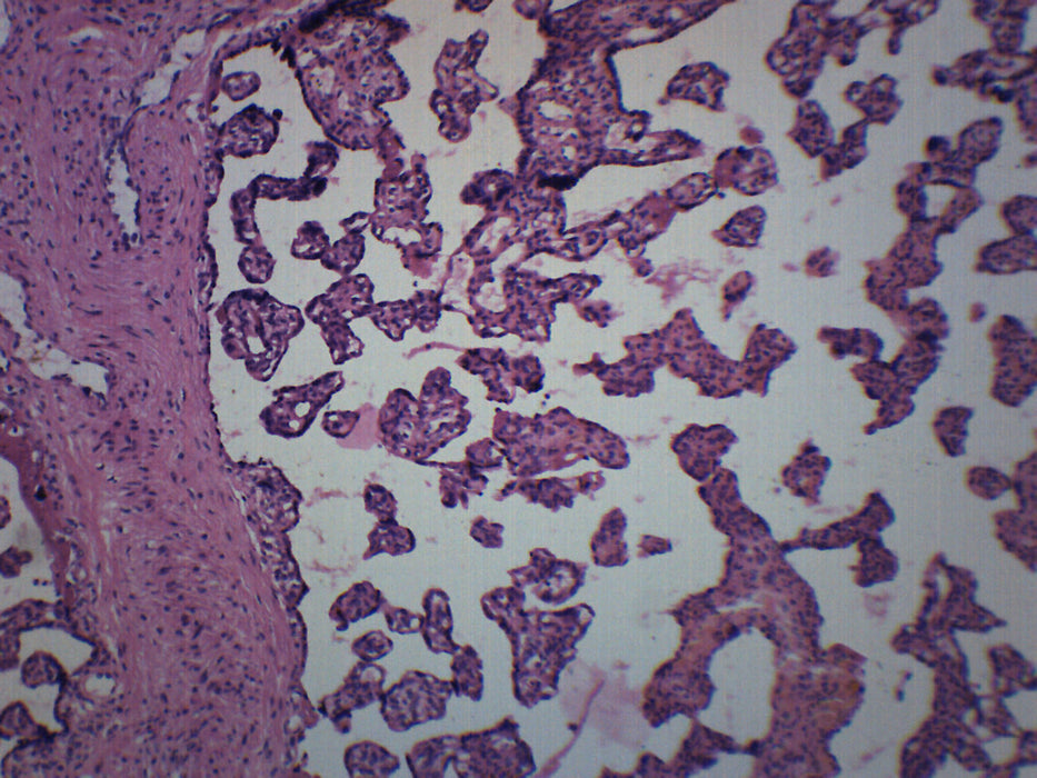Human Placenta Section - Prepared Microscope Slide - 75x25mm