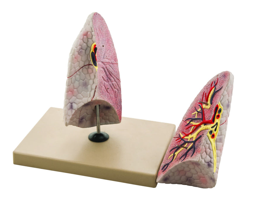 Eisco Labs Human Right Lung Anatomical Model, 2 Parts, Life Size, Approx. 10" Height