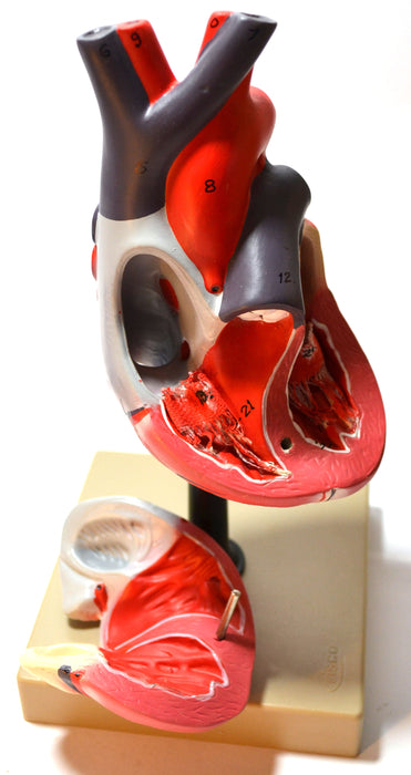 Eisco Labs Human Heart Model; Larger than Life Size (8" in height); On Diaphragm