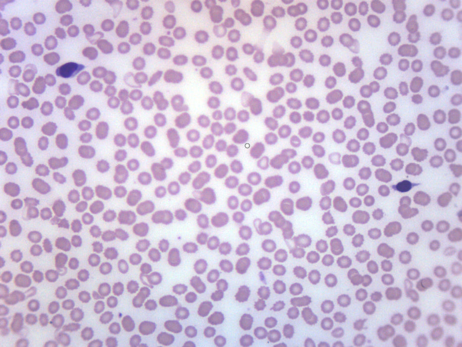Human Blood Smear WR Stain - Prepared Microscope Slide - 75x25mm