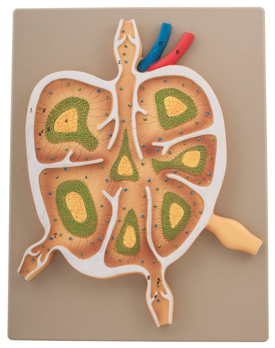 Lymph Node L.S.