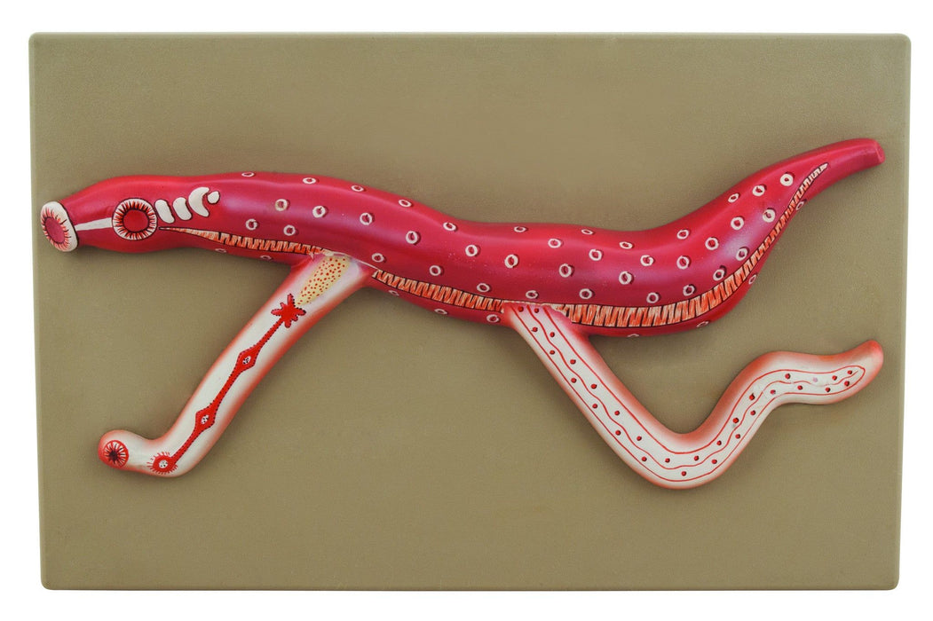 Model Bilharzia Male & Female