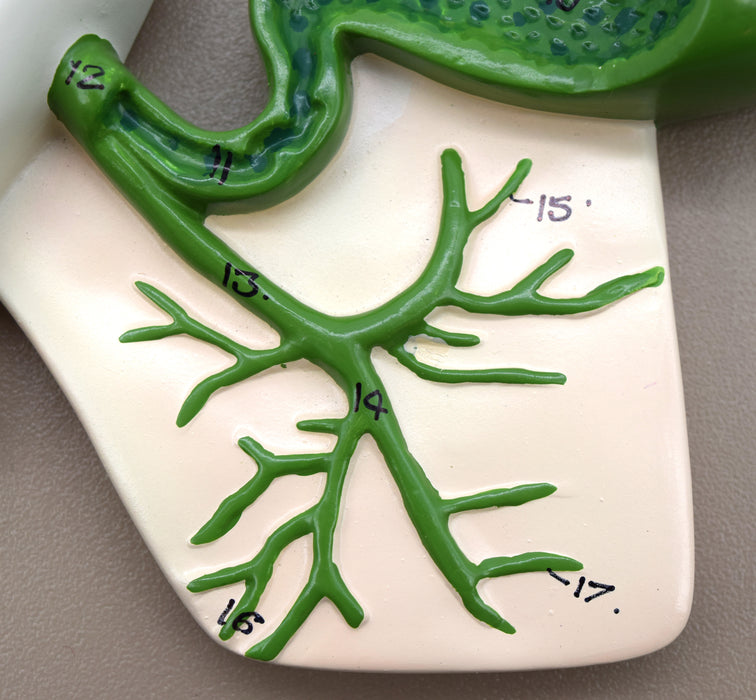 Human Pancreatic Duct Model, Three Dimensional, with Hand Painted Details - Mounted on Base, 10" x 7" - Eisco Labs