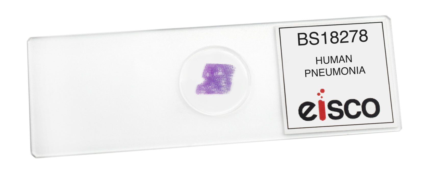 Pneumonia in Human Lungs - Prepared Microscope Slide - 75x25mm
