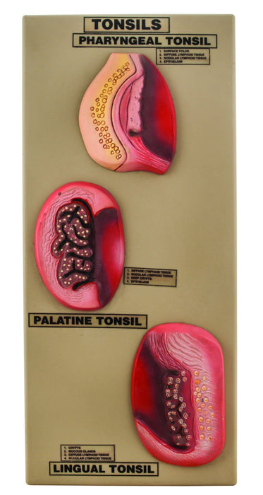 Premium Model of Tonsils - 3D View of Pharyngeal, Palatine, and Lingual Tonsils, Hand Painted with Key Card, Mounted on Base - Eisco Labs