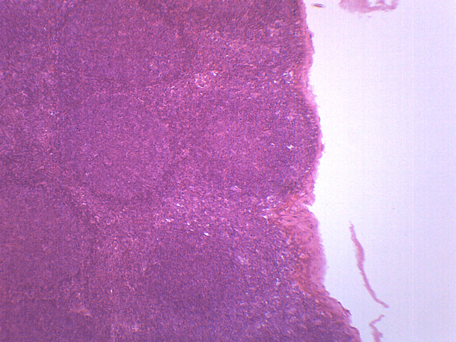 Lymph Node Section - Prepared Microscope Slide - 75x25mm