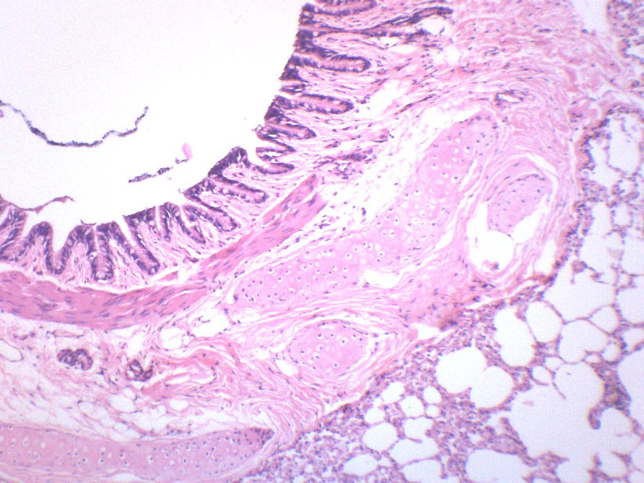 Human Lung Section - Prepared Microscope Slide - 75x25mm
