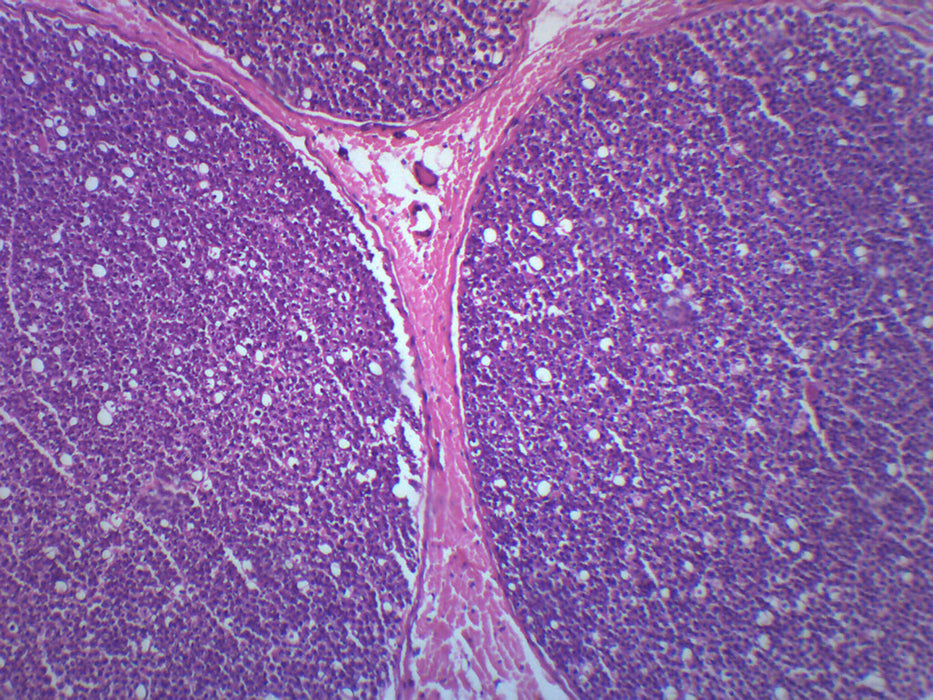 Peripheral Nerve - Cross Section - Prepared Microscope Slide - 75x25mm