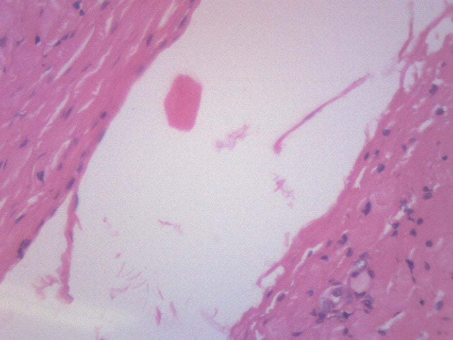 Human Artery & Vein - Prepared Microscope Slide - 75x25mm