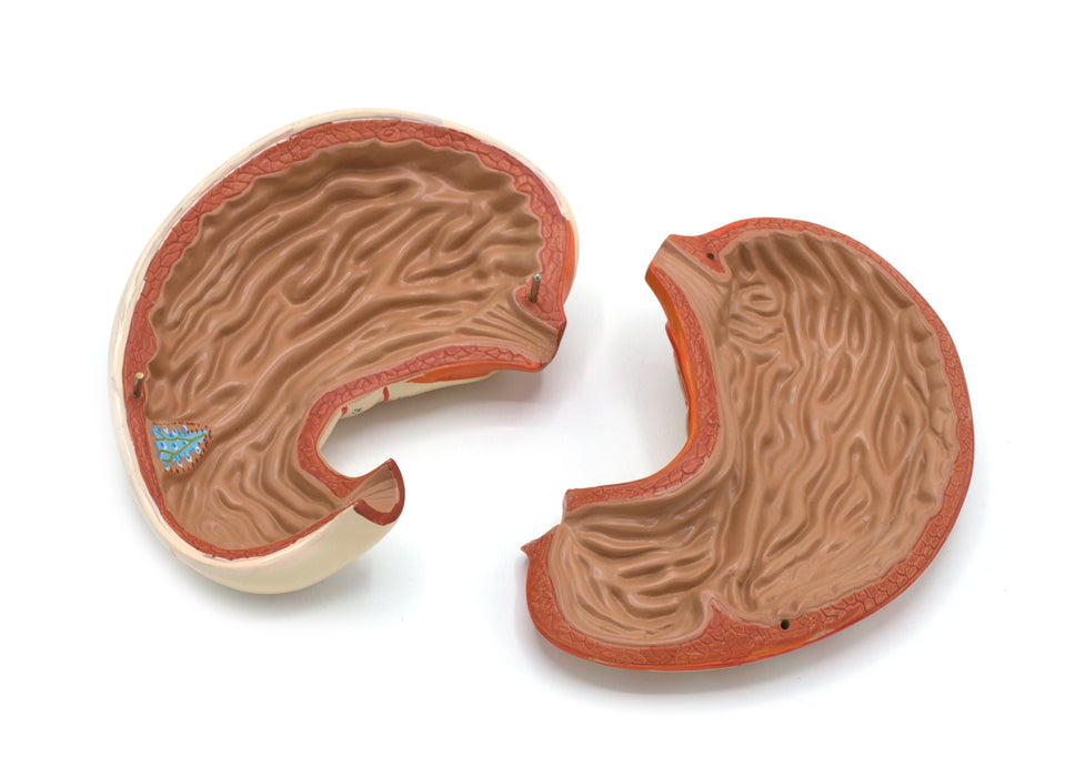 Human Stomach Bisection Model - Life Size - Eisco Labs