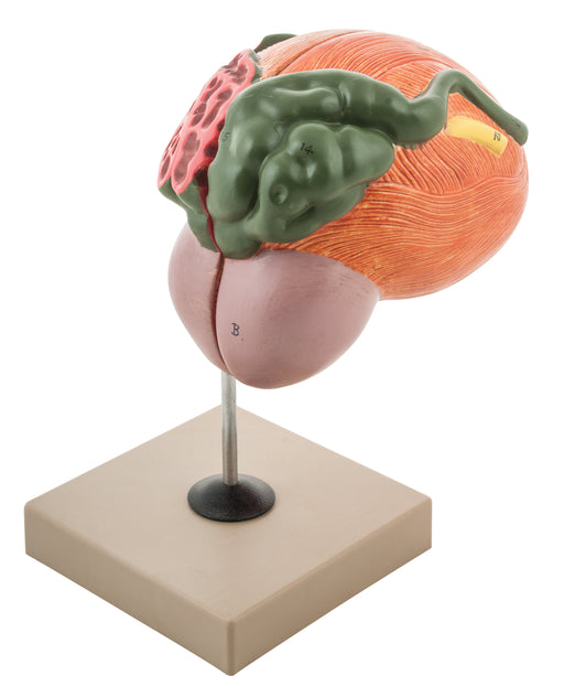 Eisco Labs Human Urinary Bladder with Prostate Anatomical Model, 2 Parts, 3 Times Life Size, Approx. 8"x8"x6"