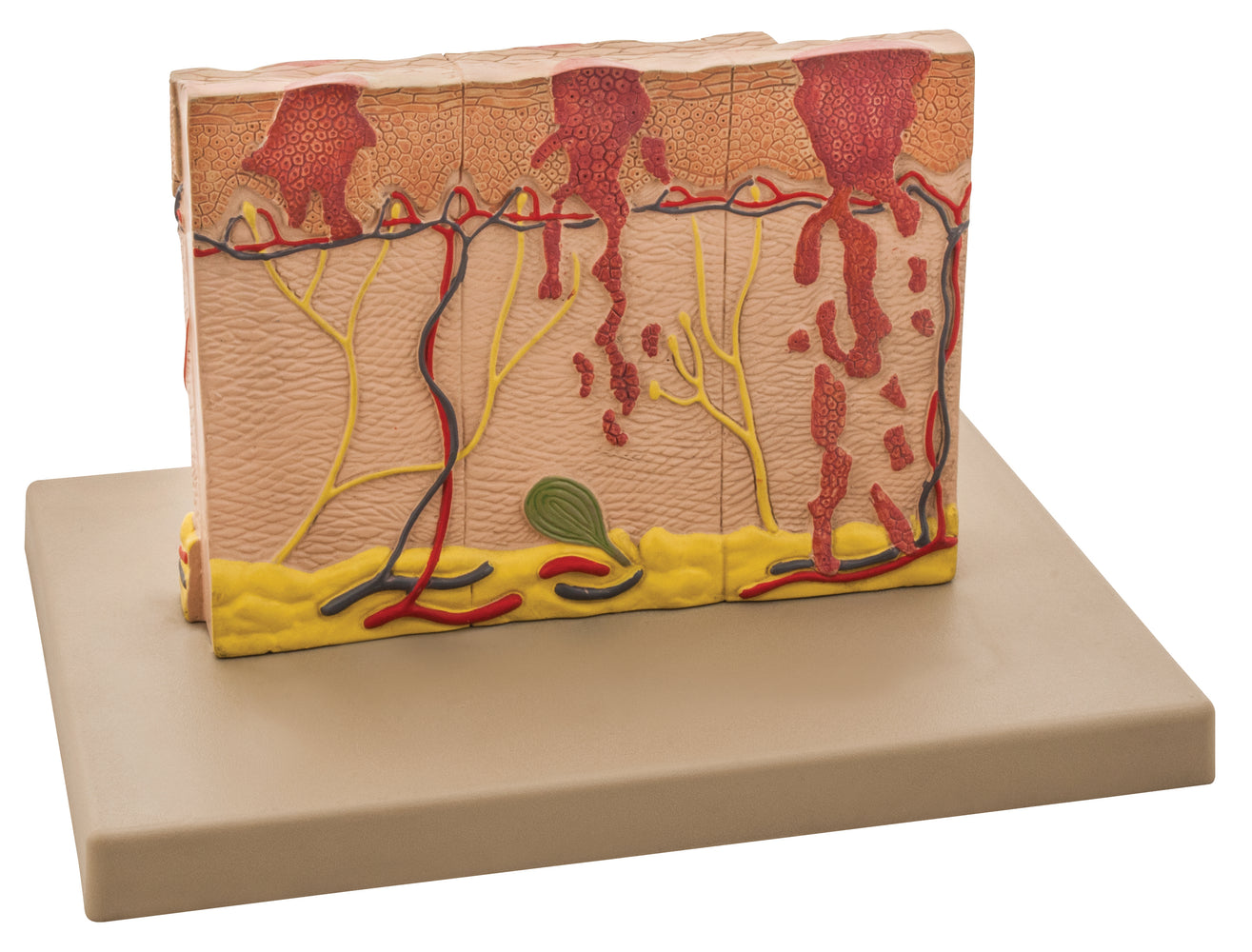 Model Human Skin, 4 times enlarged — Eisco Labs