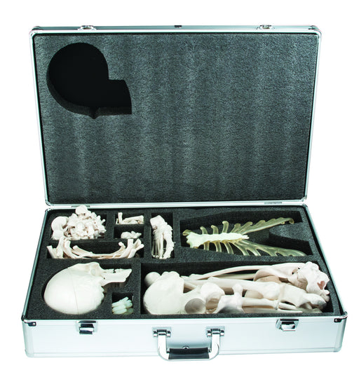 Disarticulated Skeleton with Case