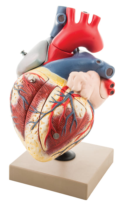 Human Heart Enlarged - 7 Parts
