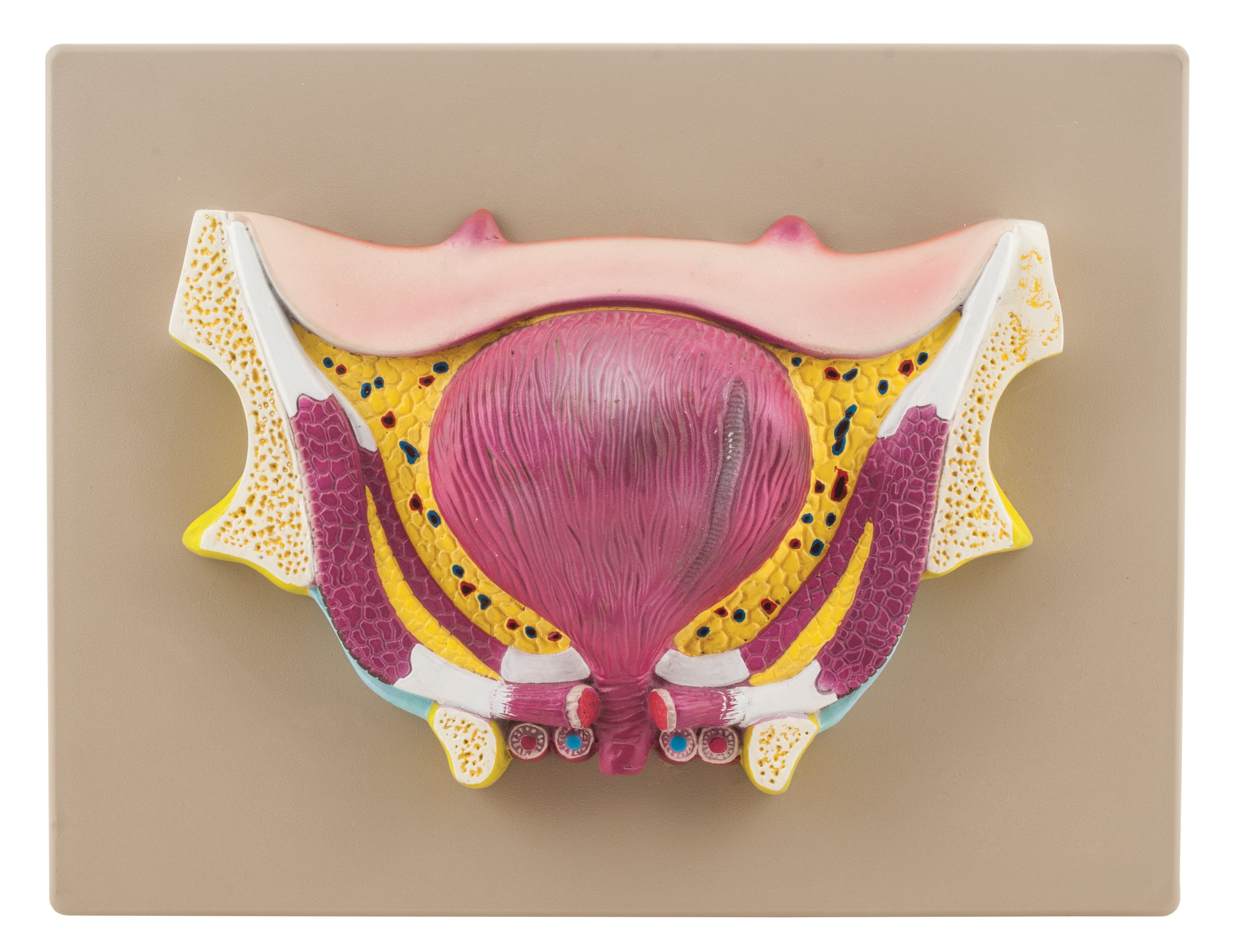Bladder Pathology — Eisco Labs