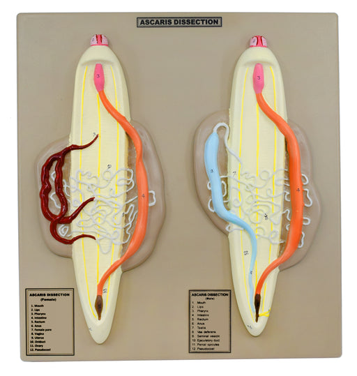 Ascaris Model, Male & Female - Enlarged, Dissection with Hand Painted Details - Mounted on Base, 14" x 13" - Eisco Labs