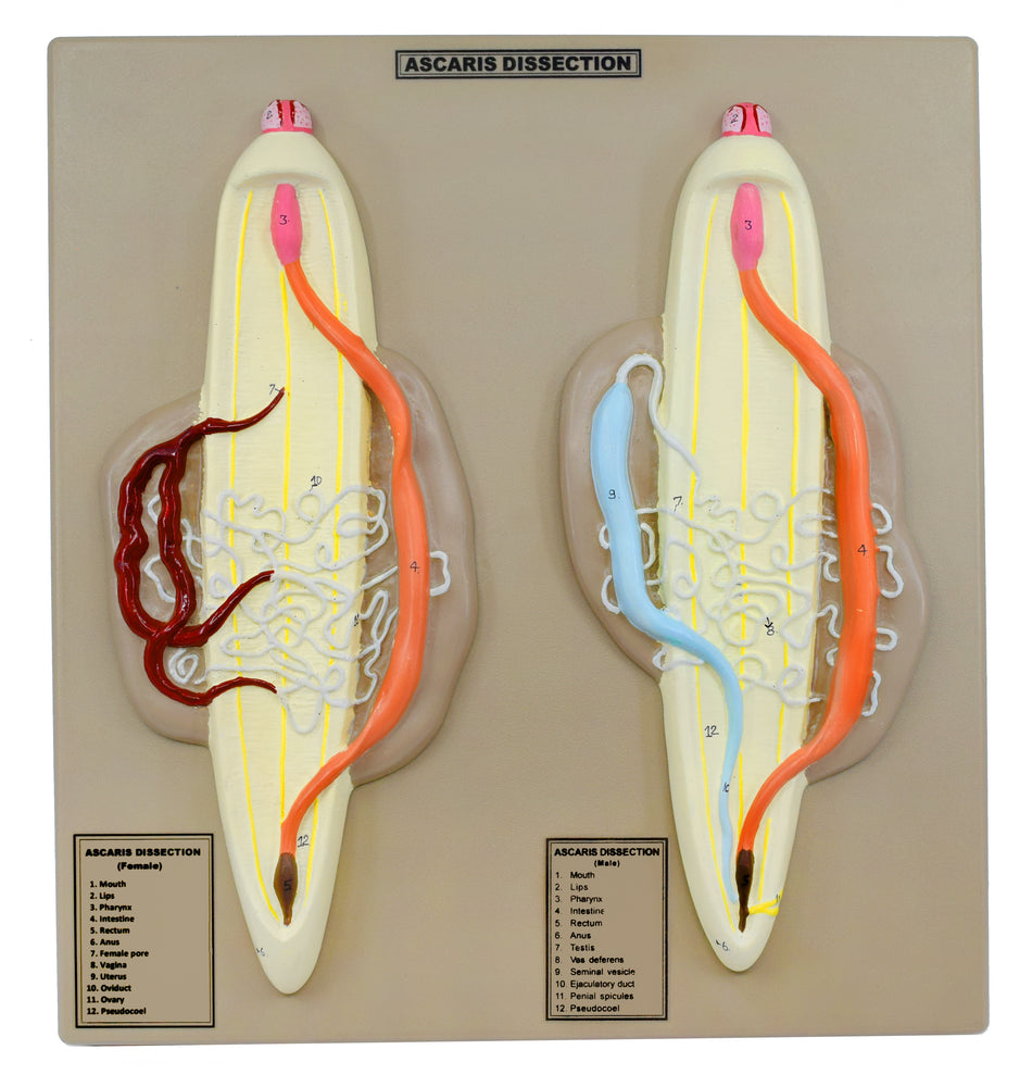Ascaris Model, Male & Female - Enlarged, Dissection with Hand Painted Details - Mounted on Base, 14" x 13" - Eisco Labs