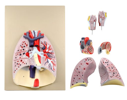 Advanced Heart & Lungs Model - Life Size - 7 Parts