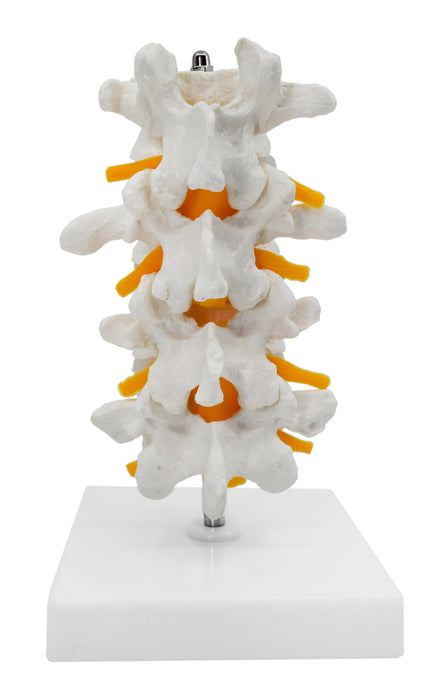 4 Lumbar Vertebrae with Nerve Branches Model, 7.25" tall on Base