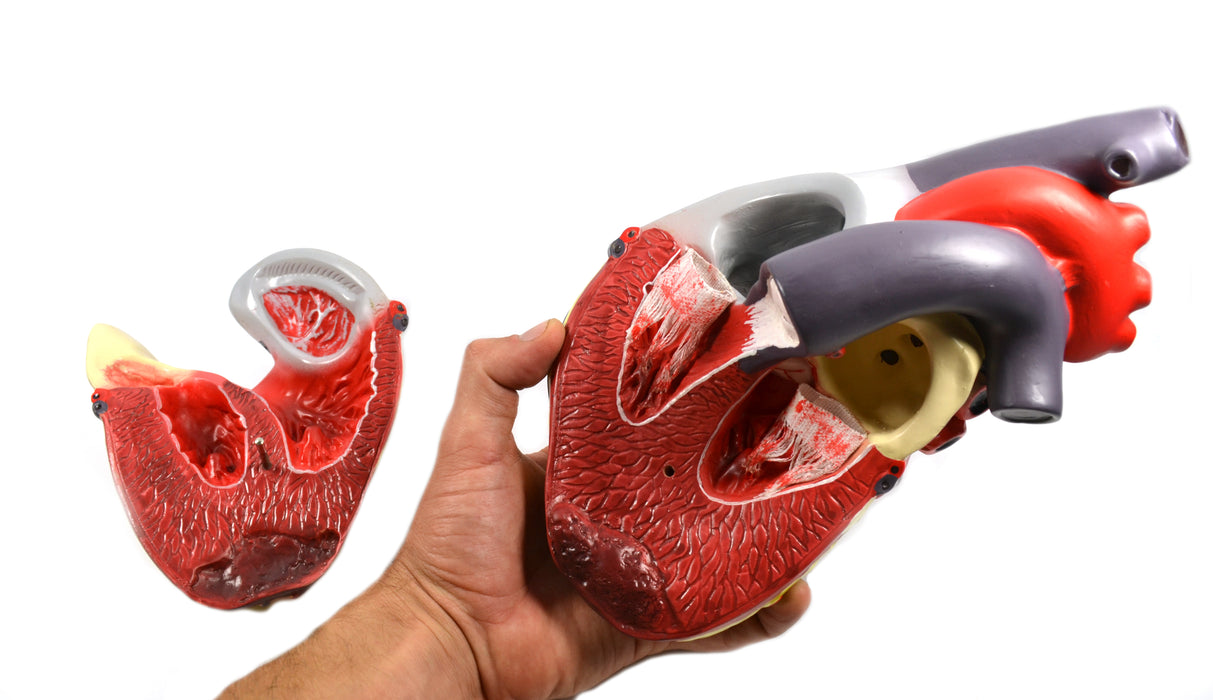 Eisco Labs Model of Human Heart Conditions Pathology; Larger than life size (10"); Artery Cross sections 2.5" in diameter
