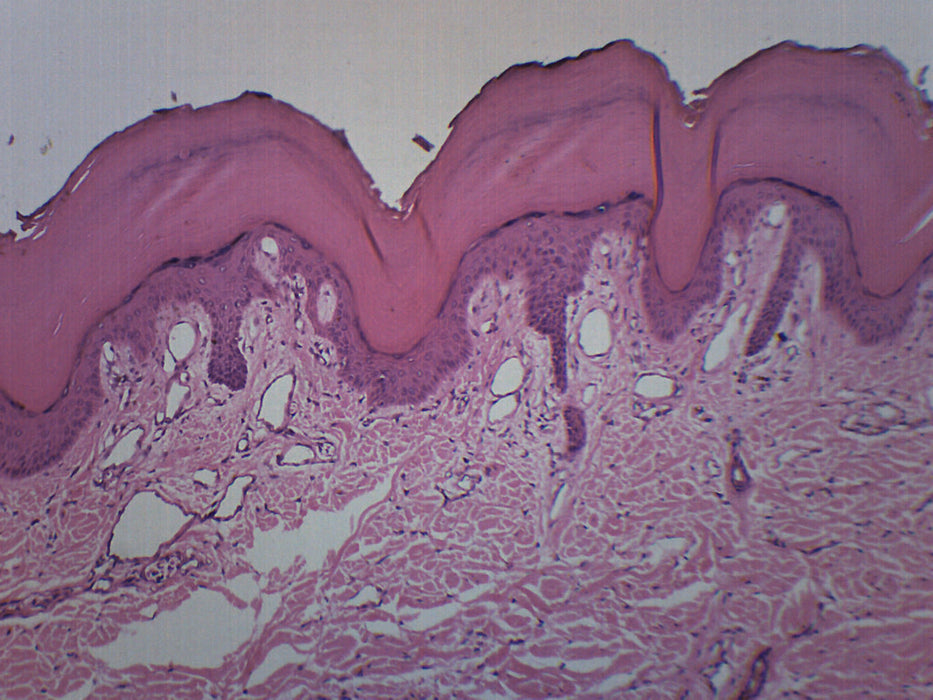 Epidermis Slide A New Approach To Border Irregularity Assessment With