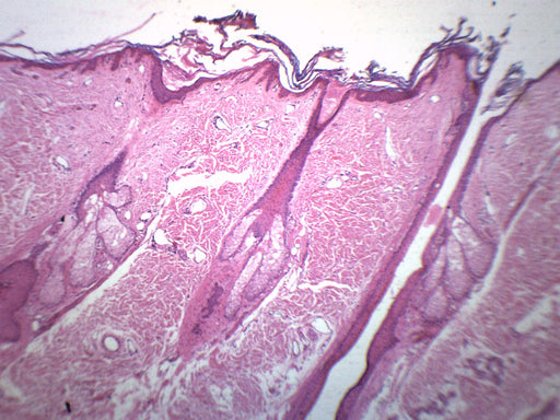 Hair Follicle - Prepared Microscope Slide - 75x25mm