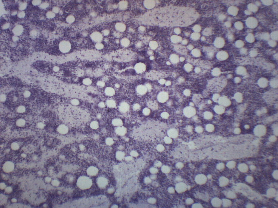 Red Bone Marrow Section - Prepared Microscope Slide - 75x25mm